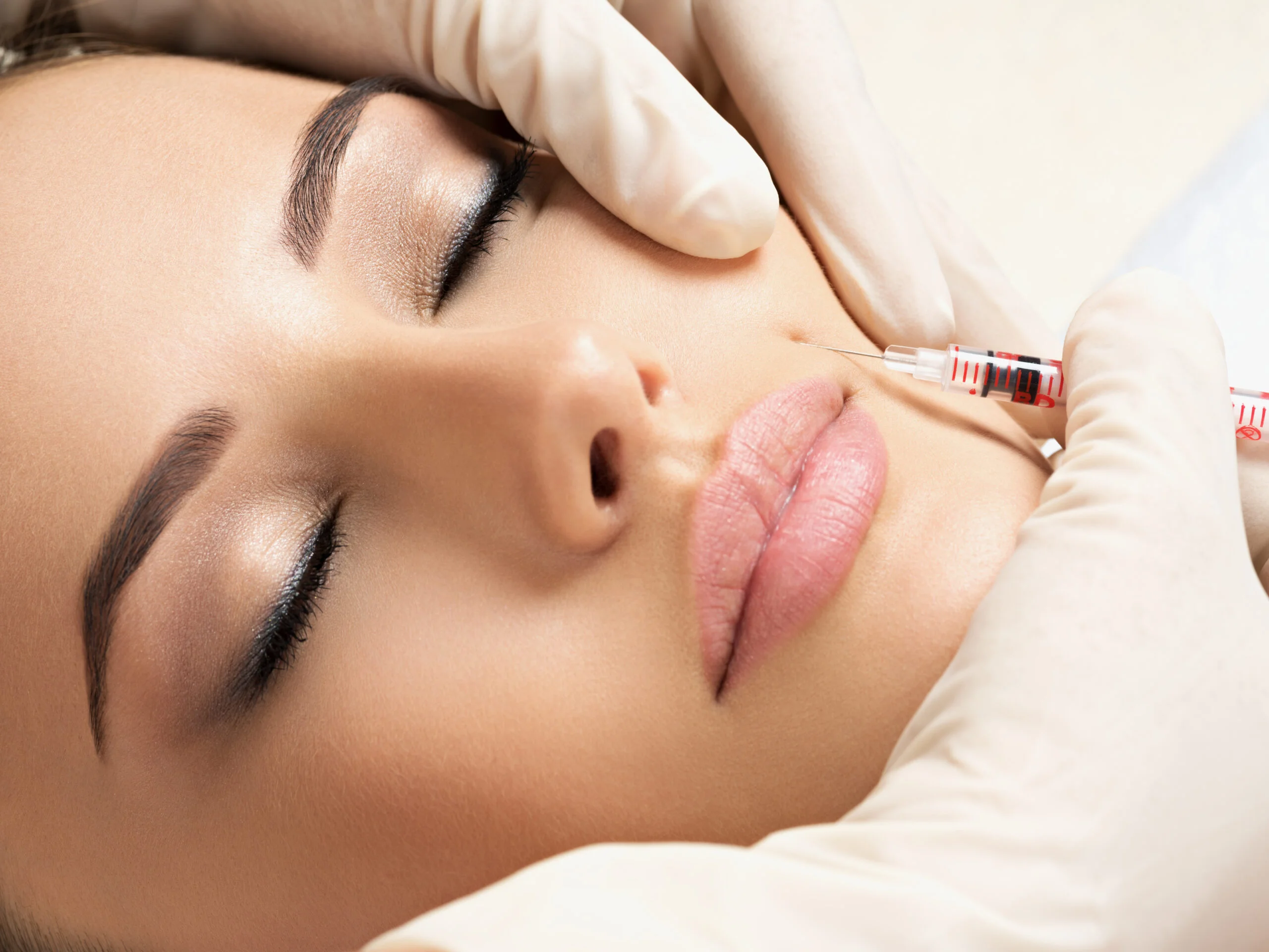 Lippen Aufspritzen Nürnberg: Sanfte Transformation für Ihre Lippen